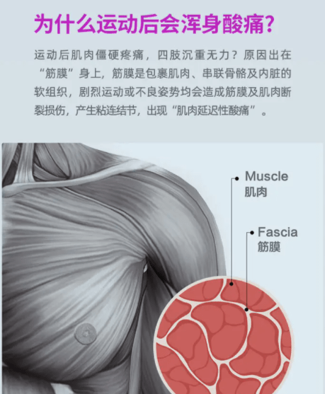 筋膜槍，是放松神器還是健康隱患？揭秘其真實效用與四大潛在風(fēng)險